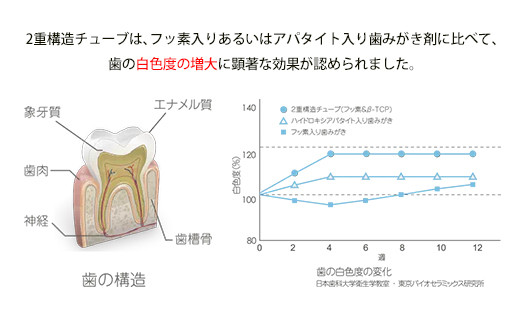 ＜歯磨き粉＞美しい歯のためにＷの効果、2層チューブ歯磨き粉「デンタパールW」  雑貨 F21R-602